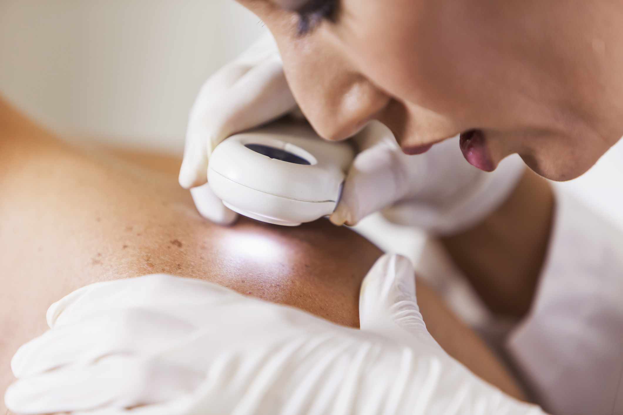 Physician Examining Patient Skin